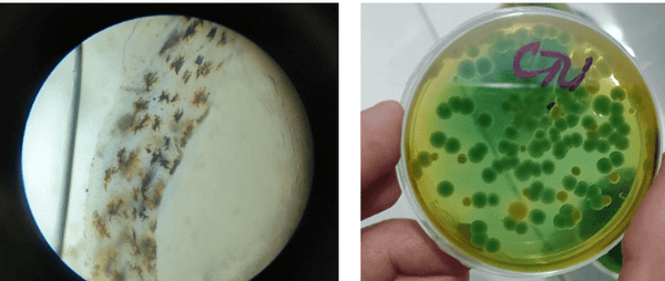 Đường ruột tôm bị nhiễm khuẩn Vibrio