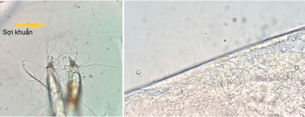 Vi khuẩn hình sợi ký sinh trên phụ bộ tôm