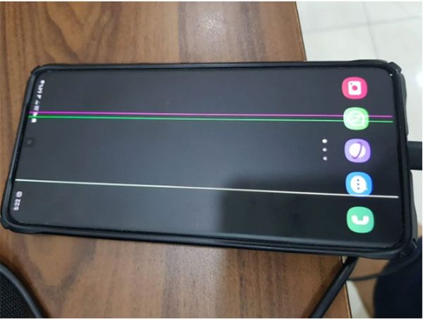 Thay Màn Hình Samsung Galaxy M53 5G