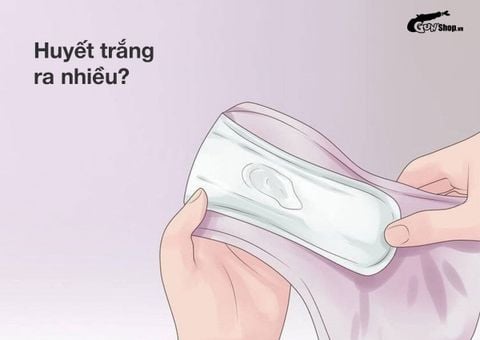 Huyết trắng ra nhiều bất thường cảnh báo điều gì?