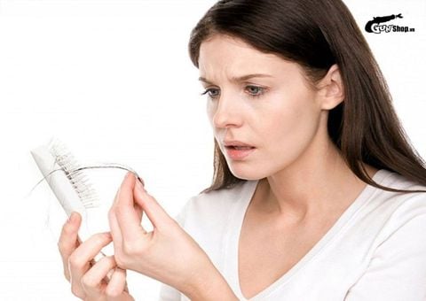 Rụng tóc nhiều là bệnh gì? Ai thường dễ bị và khắc phục như thế nào?
