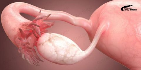 Suy buồng trứng có chữa được không? - Những lưu ý khi điều trị