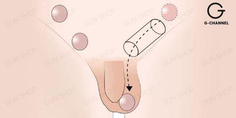 Tinh hoàn ẩn ở người trưởng thành có nguy hiểm không?