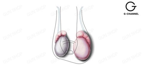 Tinh hoàn bên to bên nhỏ có nguy hiểm không? Phải làm gì?