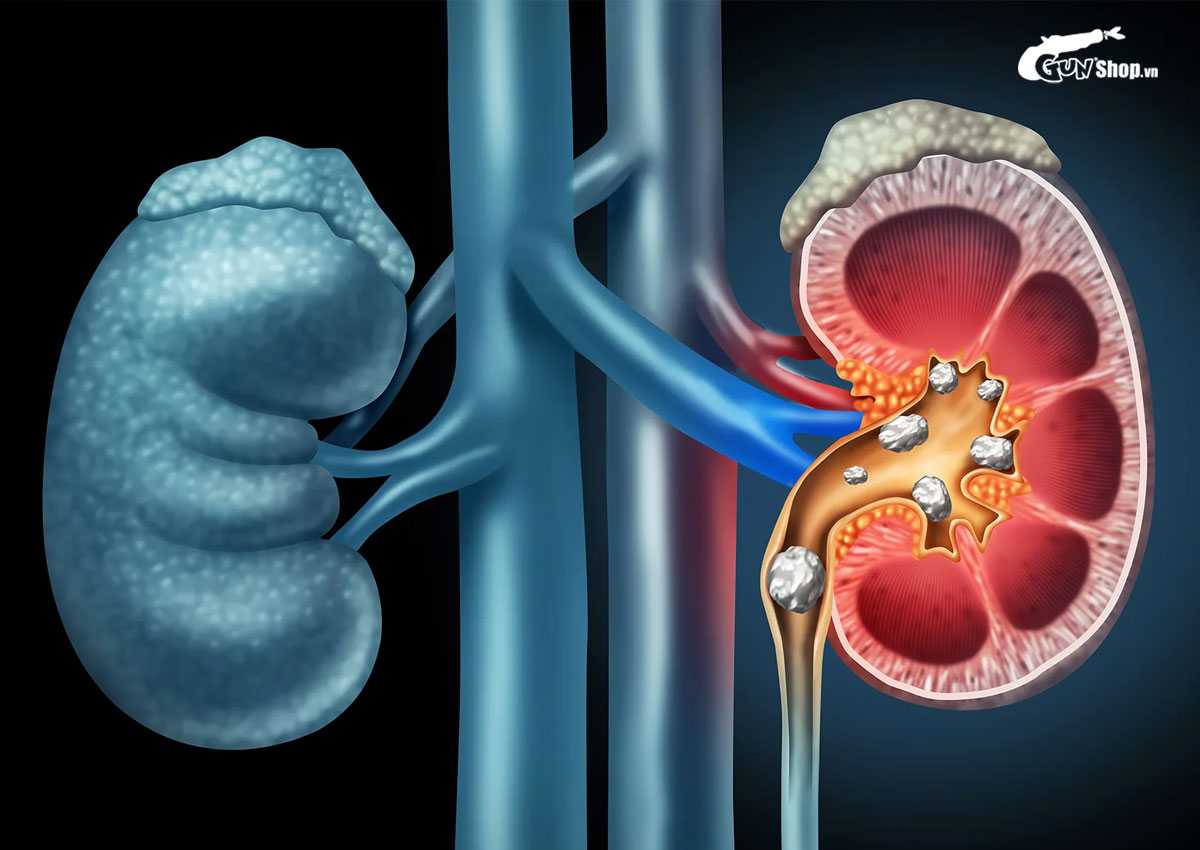 Ăn quýt có gây mụn không?