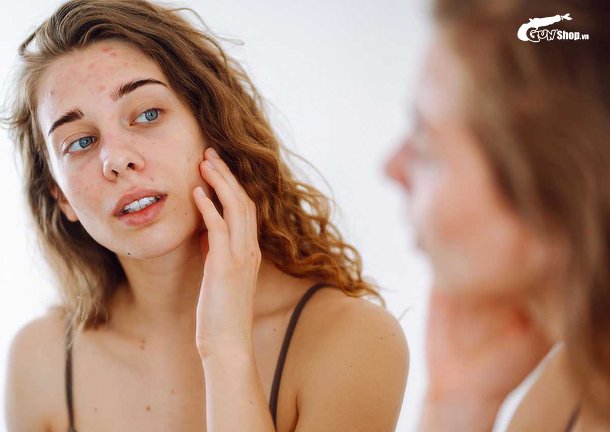 Sau khi nặn mụn không nên ăn gì?