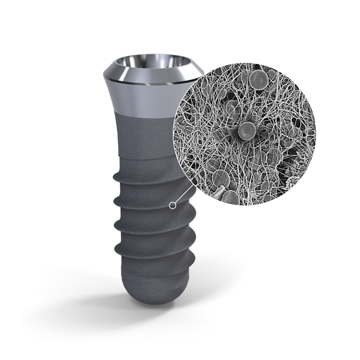 Giải đáp thắc mắc: Trồng răng implant bao nhiêu tiền?