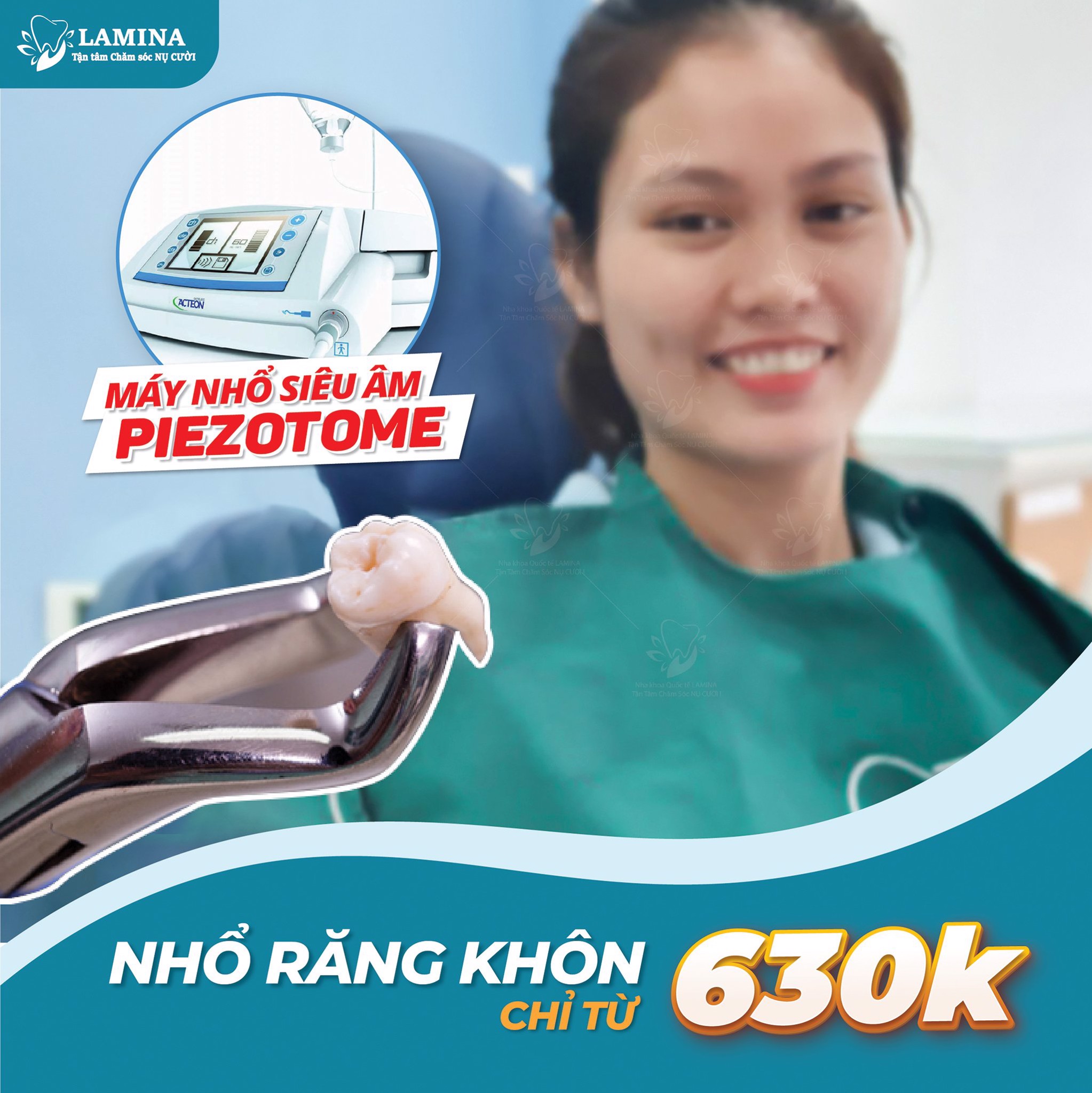 NHỔ RĂNG KHÔN MỌC