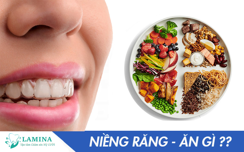 Niềng răng trong suốt nên ăn gì và không nên ăn gì