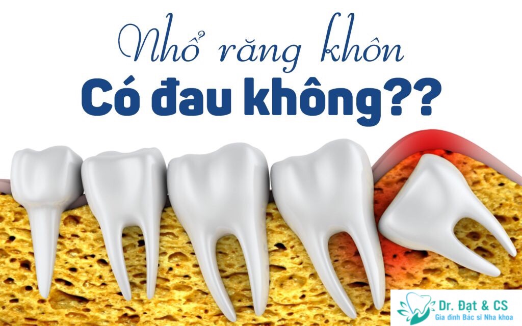 Nhổ răng khôn có đau và nguy hiểm không?