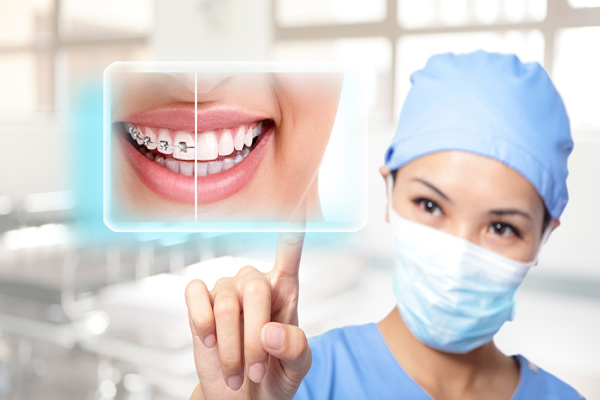 10 Lưu ý niềng răng mắc cài không thể bỏ qua