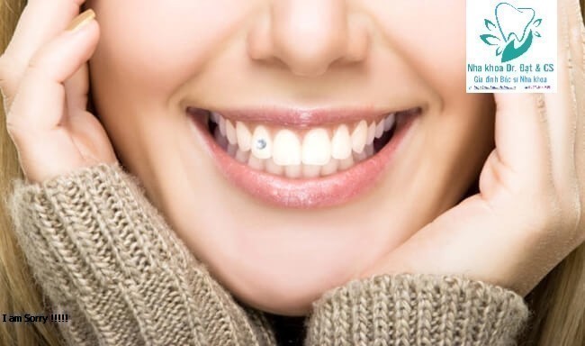 Bọc răng sứ thẩm mỹ và những điều cần biết (từ A – Z)