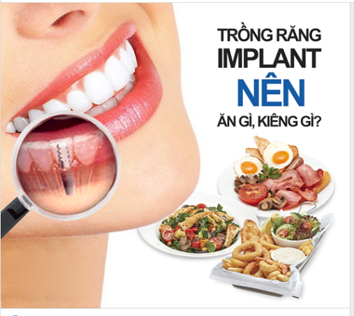 Trồng răng Implant nên ăn gì và không nên ăn gì