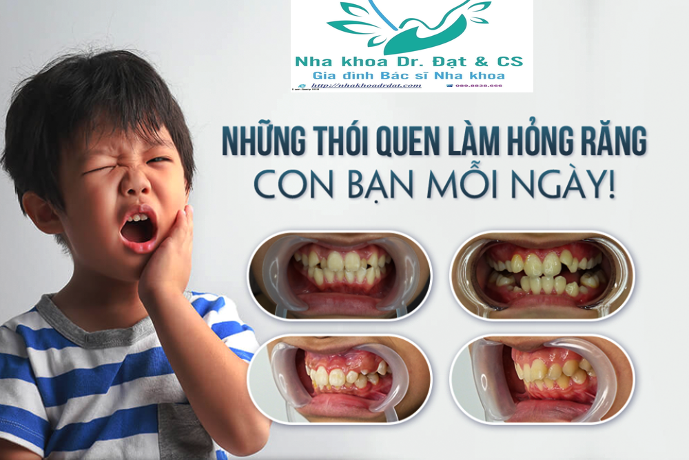 5 Thủ phạm chính gây sâu răng ở trẻ em