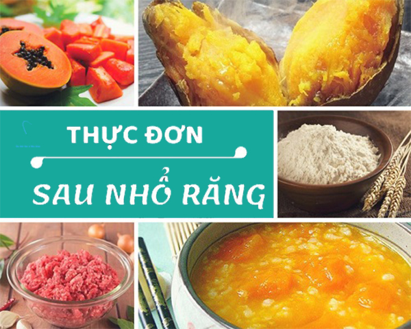 Nhổ răng khôn nên ăn gì?