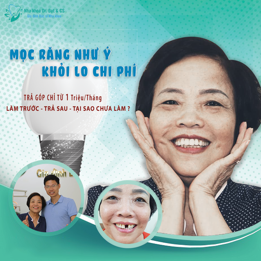 MỌC RĂNG NHƯ Ý - KHỎI LO CHI PHÍ