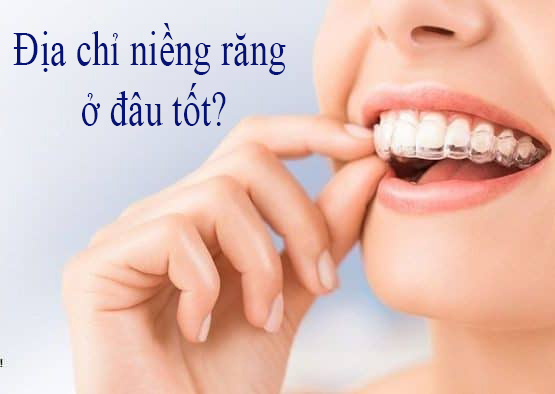 Địa chỉ niềng răng trong suốt ở đâu tốt