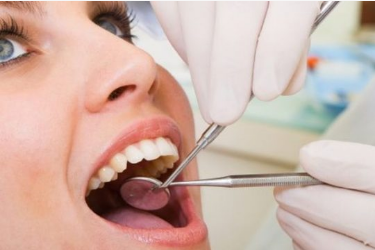 4 dụng cụ làm sạch răng chuyên nghiệp trong phòng khám nha khoa