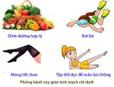 9 Phương pháp phòng bệnh suy giãn tĩnh mạch chi dưới