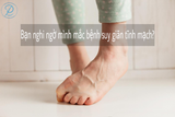 Bạn Cần Làm Gì Khi Nghi Ngờ Mình Mắc Bệnh Suy Giãn Tĩnh Mạch?