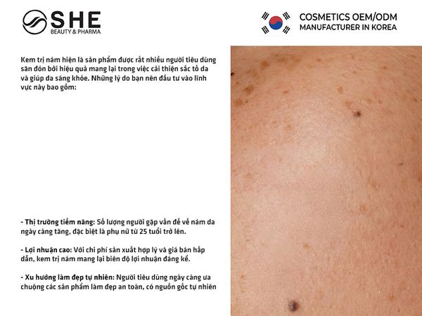 sản xuất kem trị nám 2