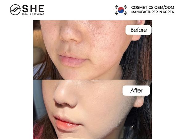 sản xuất kem trị nám 3