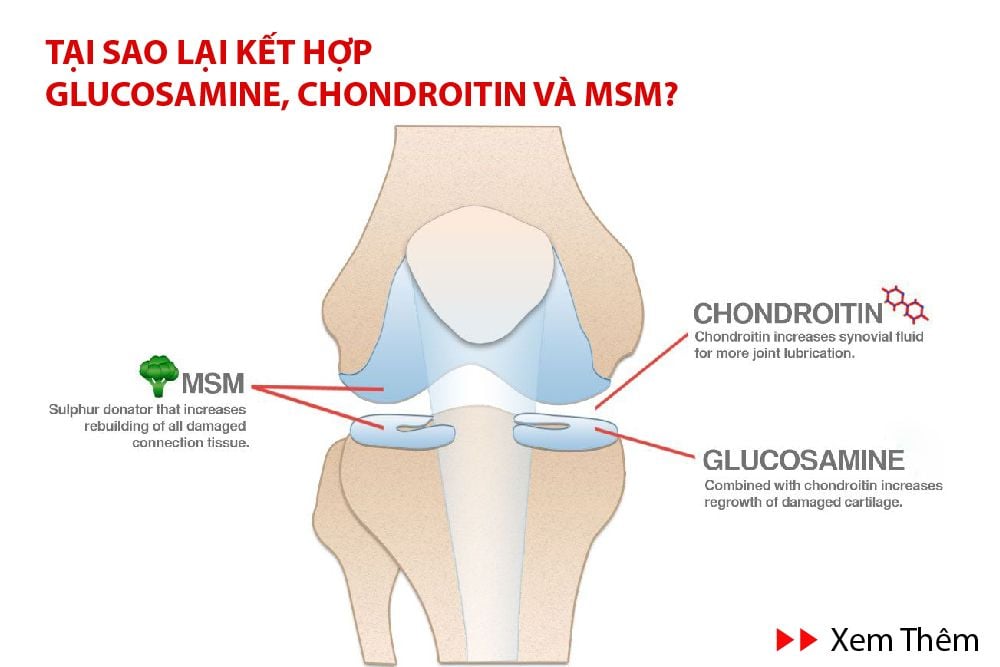 Tư vấn glucosamine chondroitin msm là gì cho sức khỏe