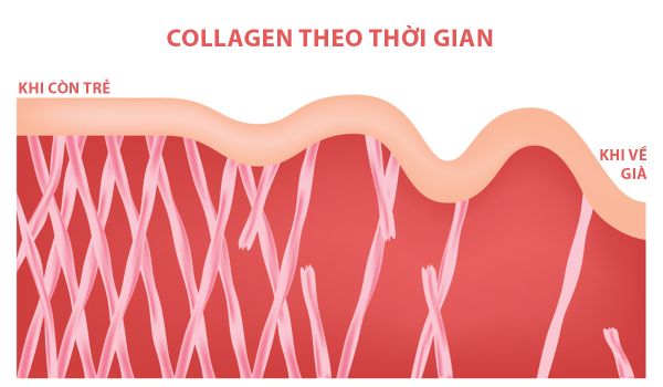 Collagen 1,2 & 3 là gì