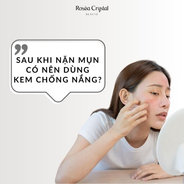 Sau Khi Nặn Mụn Có Nên Dùng Kem Chống Nắng Hay Không Rosea Crystal 