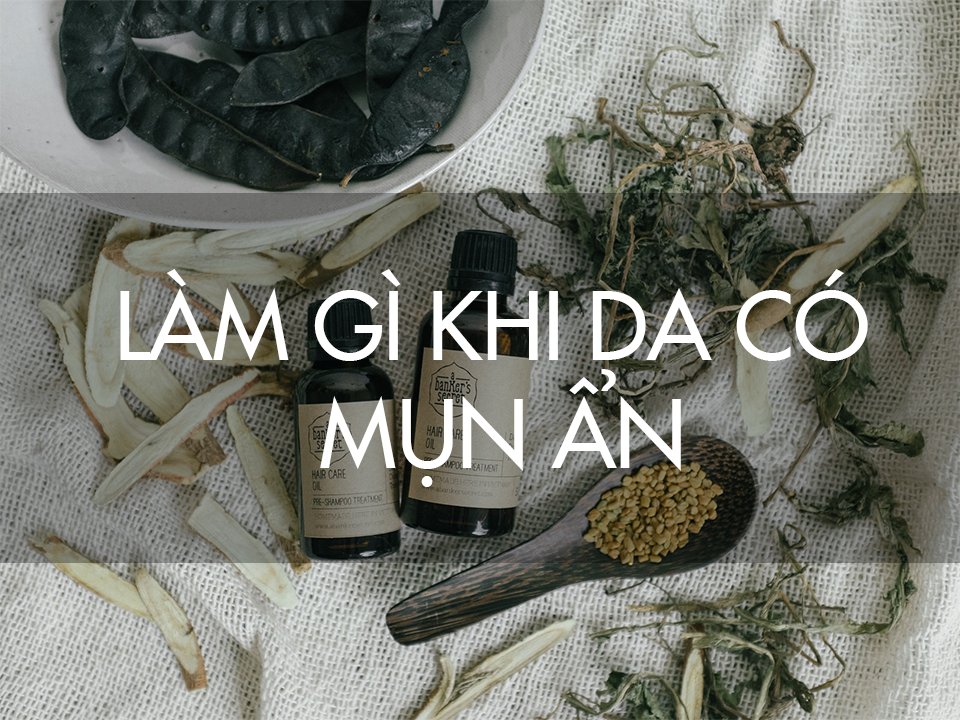 Xử lý những tên