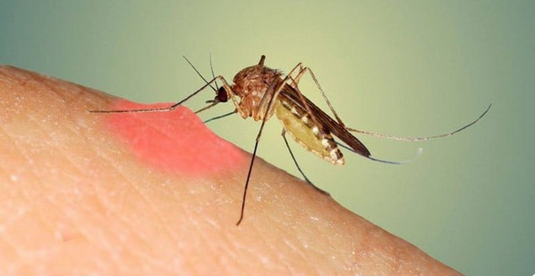 (Những vết cắn do muỗi đốt gây nên nhiều căn bệnh nguy hiểm đến tính mạng, vậy nên phòng chống muỗi đốt là việc làm cần thiết để tránh khỏi những nguy cơ tử vong)