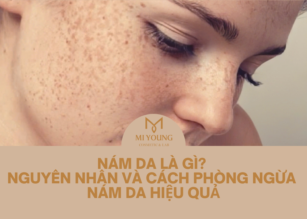 NÁM DA LÀ GÌ? NGUYÊN NHÂN VÀ CÁCH PHÒNG NGỪA NÁM DA HIỆU QUẢ