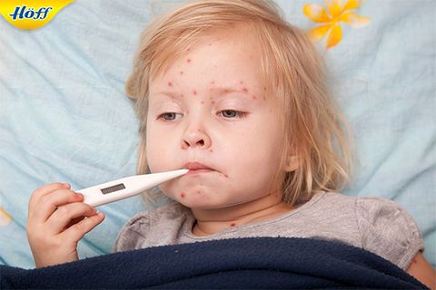 Cách chăm sóc trẻ em bị sốt xuất huyết tại nhà đúng cách