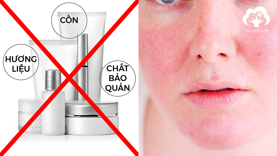 Nhận Biết Thành Phần Trong Mỹ Phẩm Để Tránh Tình Trạng Kích Ứng Da