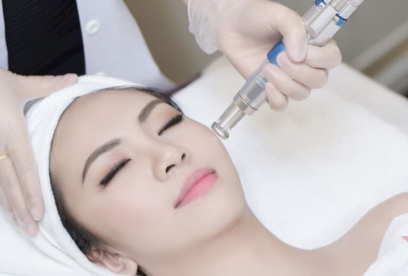 Laser Toning (PTP) là gì? Công nghệ Laser Trị nám, bớt, tàn nhang, vết