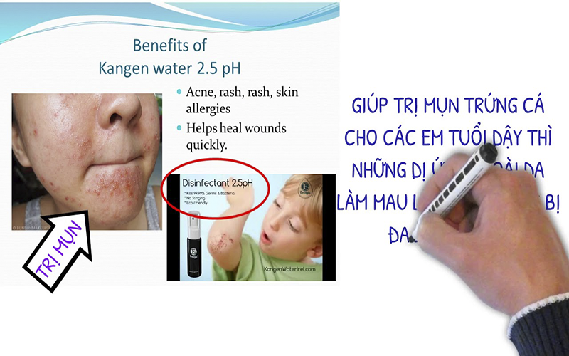 5 LOẠI NƯỚC KANGEN THẦN KỲ GIÚP CUỘC SỐNG HOÀN HẢO HƠN
