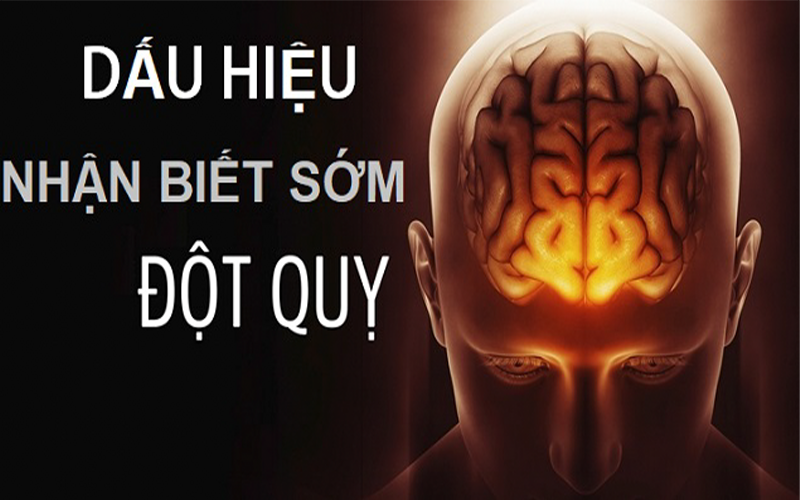 MẸO XỬ LÝ KHI NGƯỜI THÂN MẮC BỆNH ĐỘT QUỴ