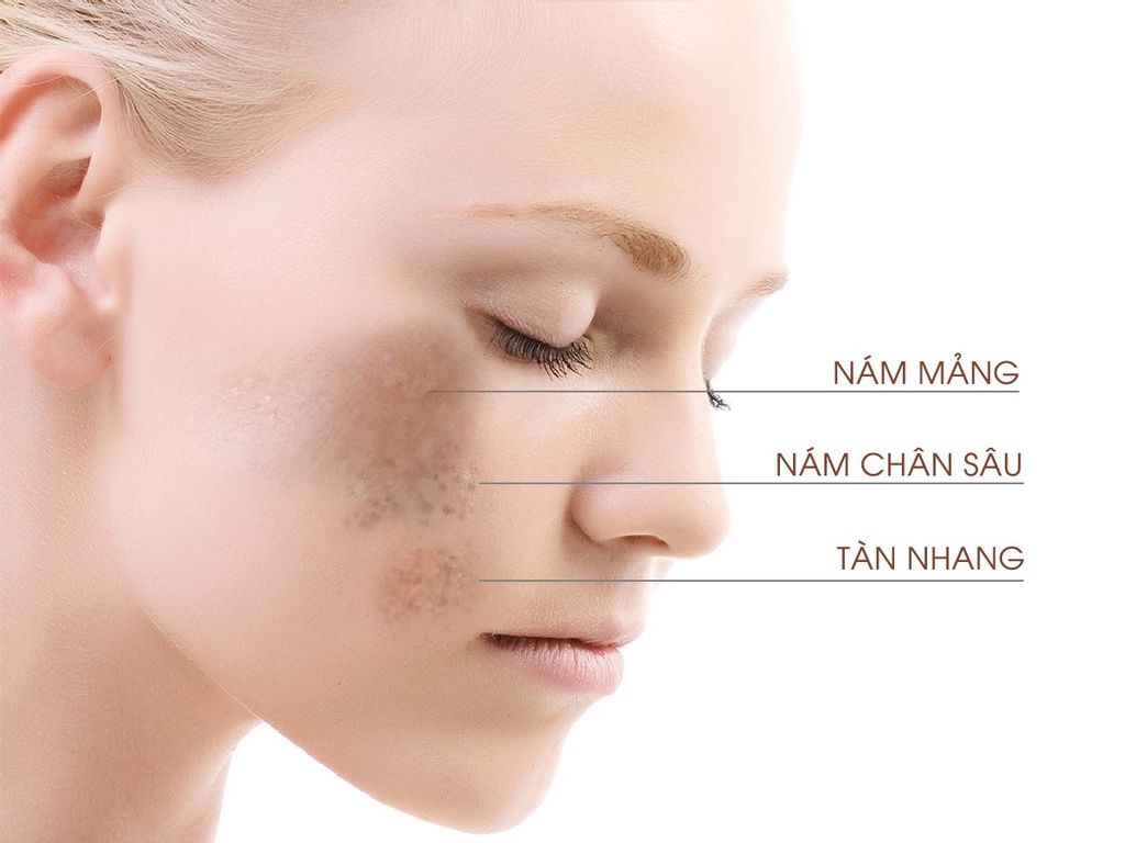 HANAYUKI BẬT MÍ BÍ KÍP ĐÁNH BAY NÁM DA CHO NHỮNG NÀNG PHẢI THỨC ĐÊM
