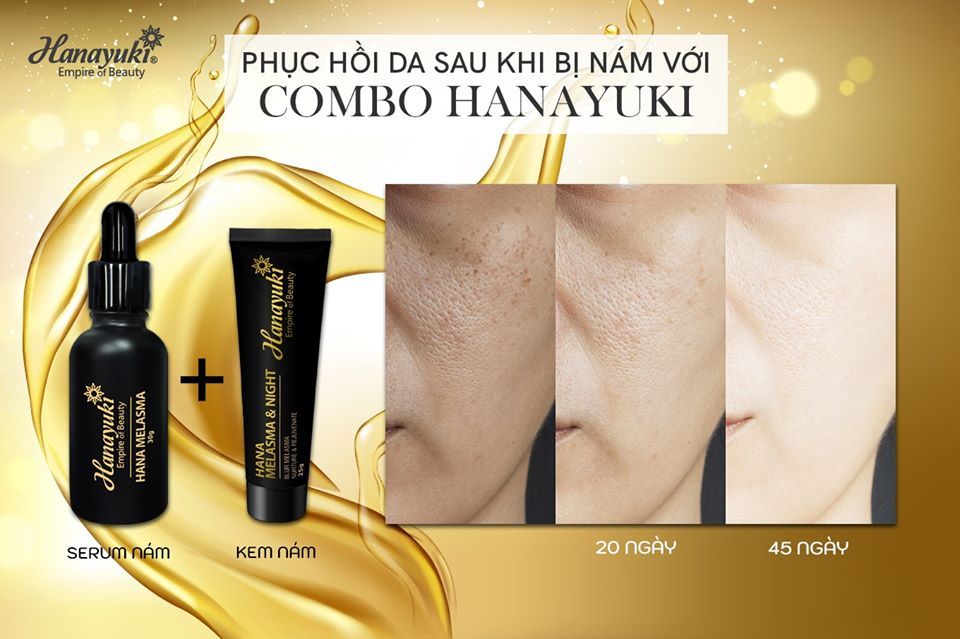 “BÍ KÍP” ĐÁNH BAY NÁM DA CHO NHỮNG NÀNG PHẢI THỨC ĐÊM