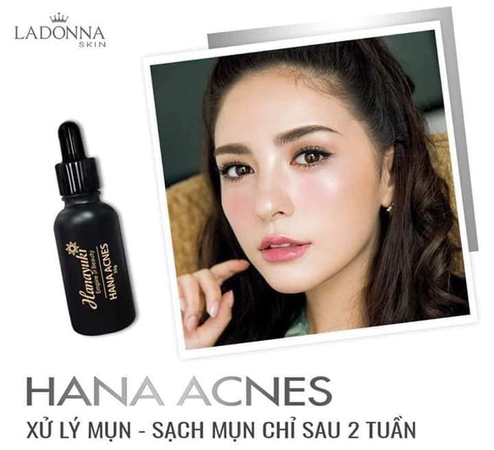 TRỊ MỤN VỚI MỸ PHẨM HANAYUKI TRONG BAO LÂU THÌ HẾT MỤN?