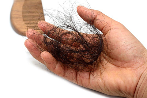 7 cách ngăn rụng tóc tại nhà đơn giản