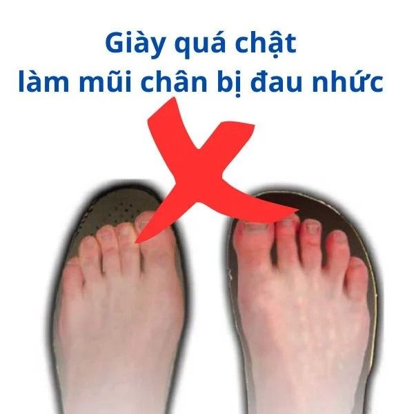 Giày quá chật sẽ khiên chân bị đau nhức
