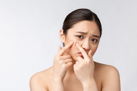 DA DẦU MỤN CẦN ĐƯỢC CHĂM SÓC NHƯ THẾ NÀO VÀO MÙA ĐÔNG