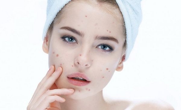 Hình ảnh bài viết