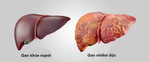 Hình ảnh bài viết