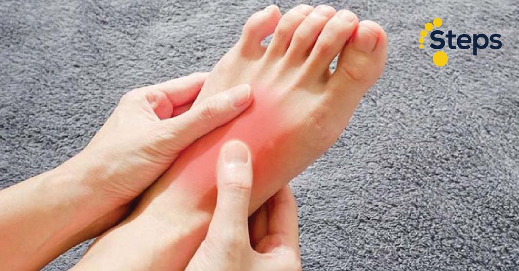 Các dấu hiệu giúp bạn nhận biết về bệnh mu bàn chân