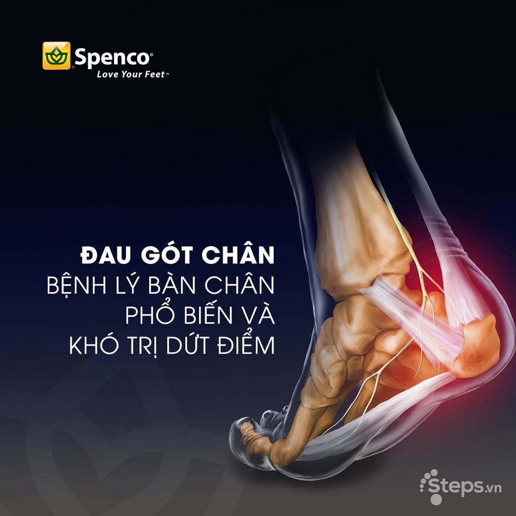 Đau Gót Chân: Nguyên Nhân, Triệu Chứng và Cách Điều Trị
