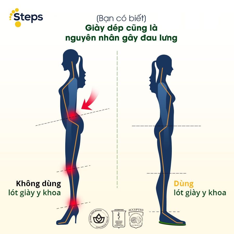 Giày dép cũng là nguyên nhân gây đau lưng