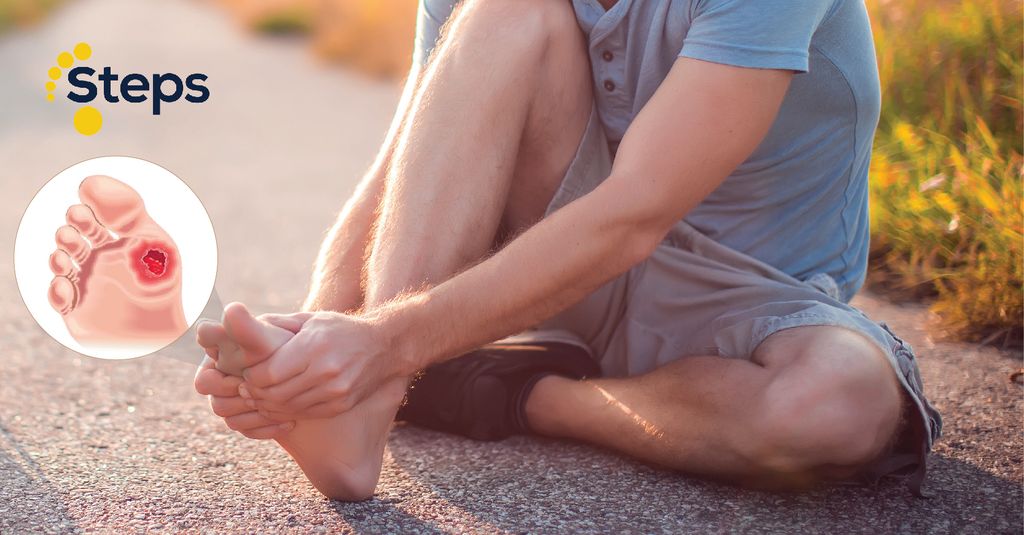 Bàn chân tiểu đường cần quan tâm đến những loại giày dép sức khoẻ nào?