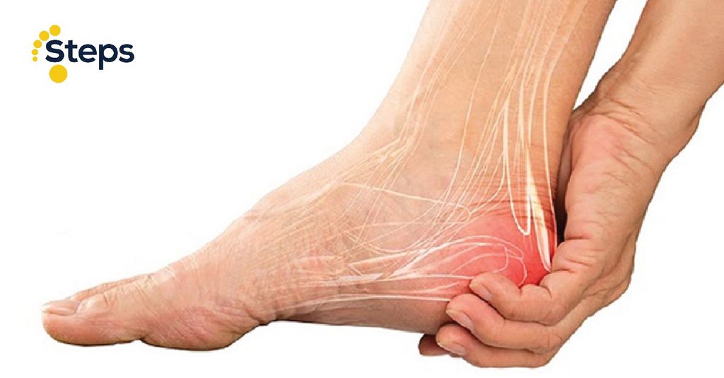 Bí quyết giảm đau gót chân hiệu quả nhanh chóng với giày dép chỉnh hình Spenco